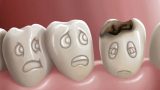 Gülüşünüze İyi Gelecek: Diş Bakımında Doğru Bilinen 8 Yanlış!